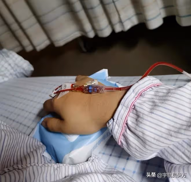雲南女生捐髓救人,被母親相逼中途反悔,致患者險喪命