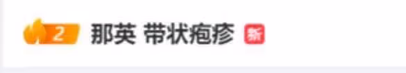 劇痛!那英被曝患病,醫生提醒:會傳染