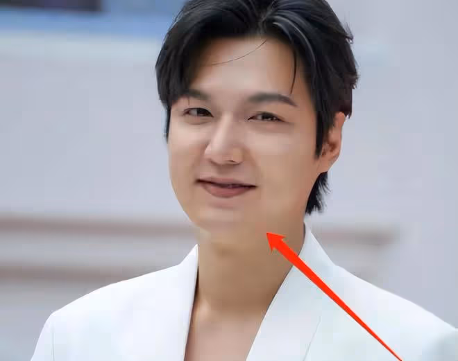 37歲李敏鎬發福變雙下巴,臉部變得圓潤,差點沒認出來
