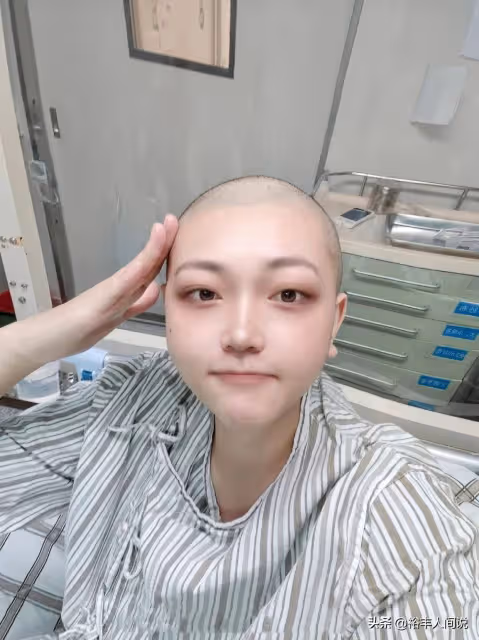 痛心!25歲網紅劉像樣去世,發燒沒當回事,30天癱瘓40天頭髮掉光
