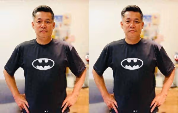 汪建民驚罹肺腺癌四期　已擴散到腦部