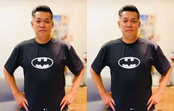 汪建民驚罹肺腺癌四期！癌細胞已擴散到腦部