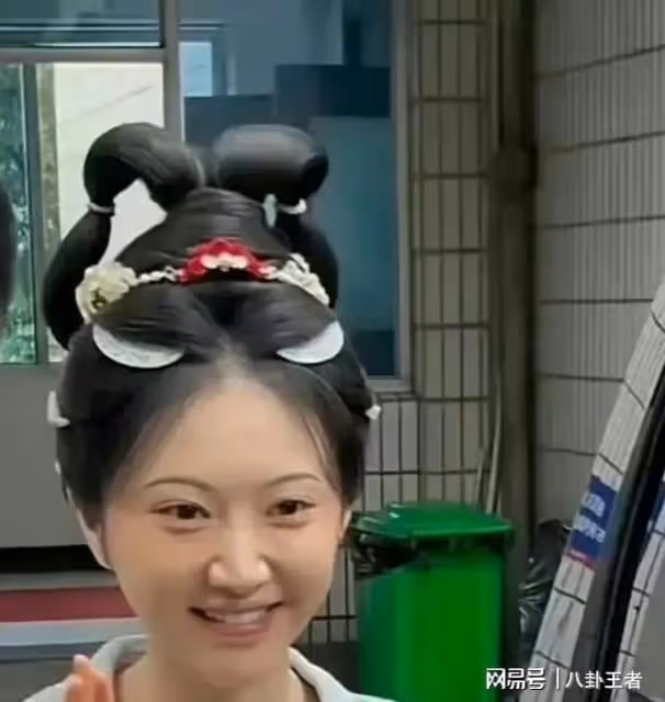 景甜整容失敗!臉腫脹僵硬,眼睛縮小一倍,女神慘變悲傷蛙太可怕