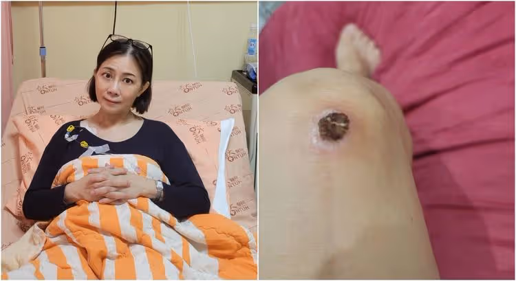 小彤小擦傷三週才好　抗癌化療中報喜訊：女兒不會成孤兒了　