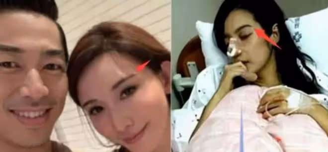 50歲林志玲帶兒子外出,身材苗條像30歲,臉卻暴露真實年齡
