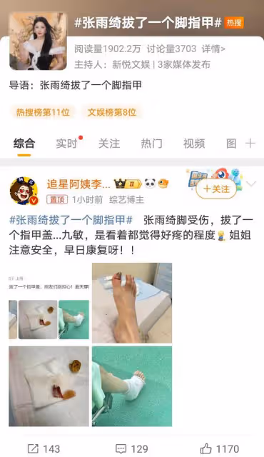 張雨綺意外摔傷拔甲，堅強面對引人關注，娛樂圈安全話題再被提起