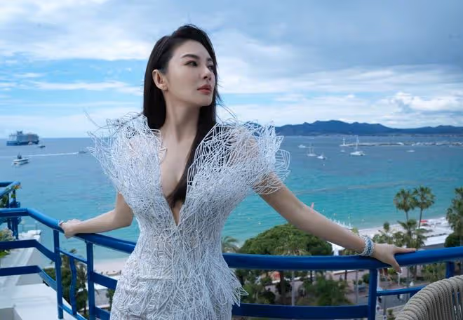 張雨綺意外摔傷拔甲，堅強面對引人關注，娛樂圈安全話題再被提起