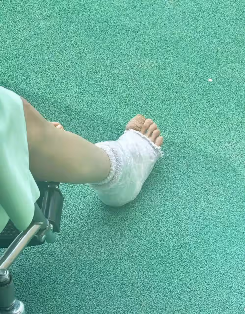 隔著螢幕都覺得疼!張雨綺拍戲腳指頭受傷被拔指甲