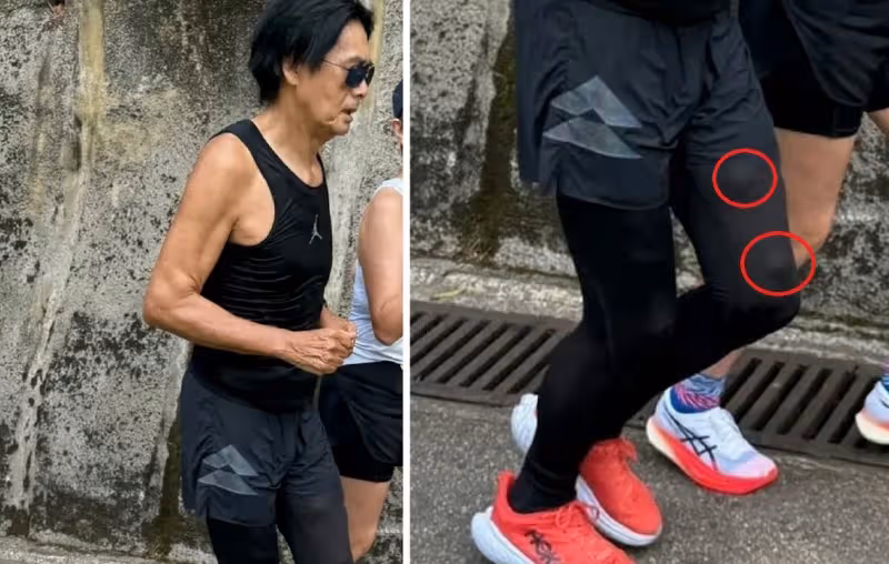 69歲周潤發還好嗎？不只大腿凸兩粒　手臂冒出多顆大肉球
