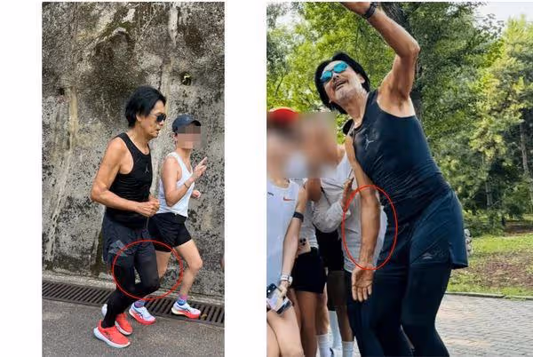 69歲周潤發「大腿內側冒出2顆大肉球」！　網一看嚇壞：手臂上儘是包