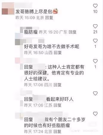 69歲周潤發「大腿內側冒出2顆大肉球」！　網一看嚇壞：手臂上儘是包