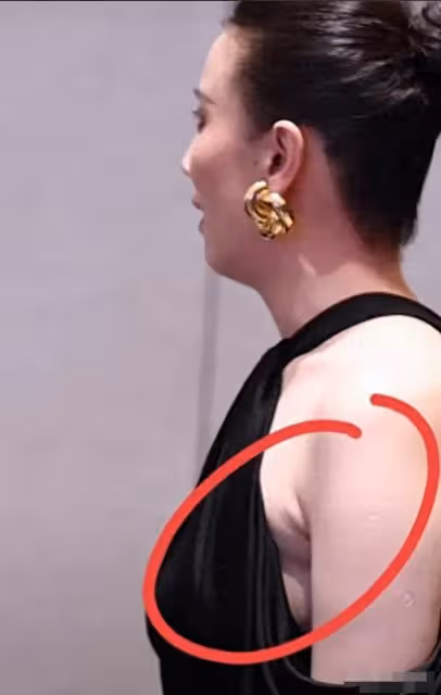 43歲宋佳近照!腋下副乳明顯,真空禮服險走光,胳膊上痕跡引爭議