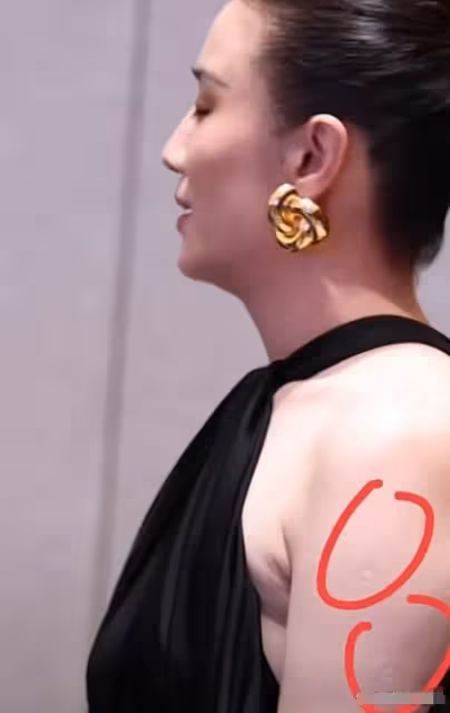 43歲宋佳近照!腋下副乳明顯,真空禮服險走光,胳膊上痕跡引爭議