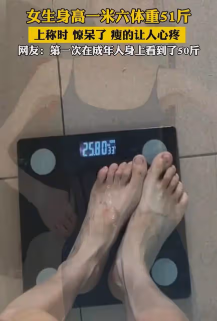 1米6女生體重50斤還減肥,胳膊腿一般粗一折就斷,細得讓人心疼