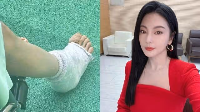 《長江七號》女星驚傳濺血「指甲整片沒了」! 坐輪椅包紗布傷勢曝光