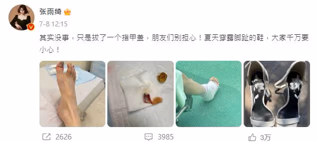 《長江七號》女星驚傳濺血「指甲整片沒了」! 坐輪椅包紗布傷勢曝光