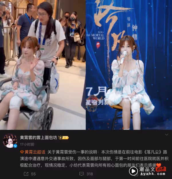 演出前遭遇車禍!黃霄雲坐輪椅+戴面紗現身表演 導演秒哭!