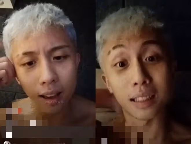 孫安佐募資70萬飛烏克蘭打仗!狄鶯「呵呵」乾笑兩聲回應