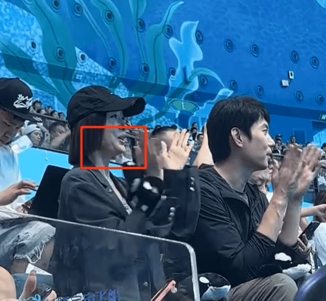 44歲秦嵐離開濾鏡後的真實面貌:法令紋深太顯老,狀態很差!