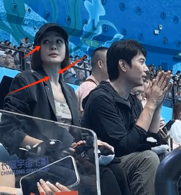 44歲秦嵐離開濾鏡後的真實面貌:法令紋深太顯老,狀態很差!