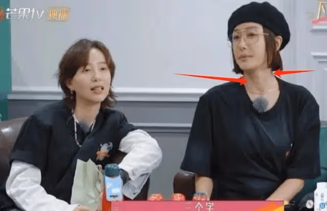 44歲秦嵐離開濾鏡後的真實面貌：法令紋深太顯老，狀態很差！