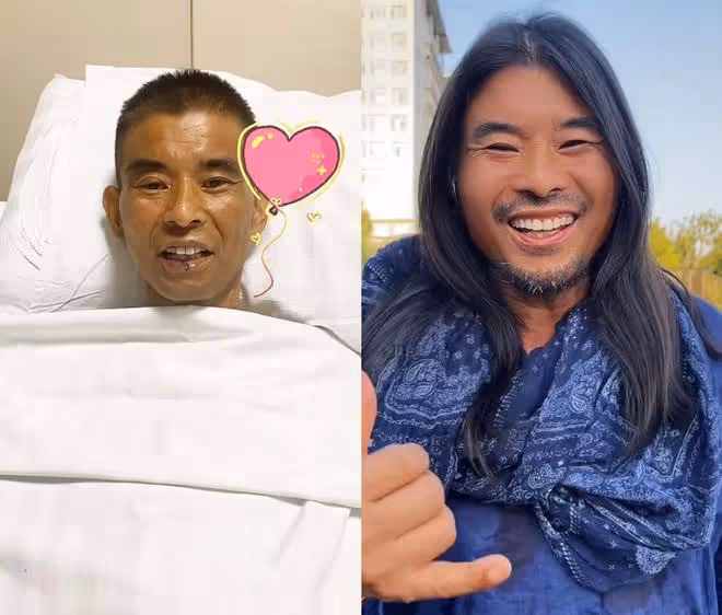 麵筋哥報平安!肝移植後感謝大家的救命之恩,剪掉長發重新生活
