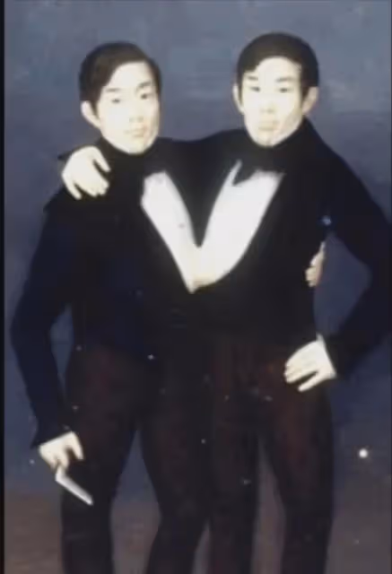連體人也能結婚生子?兄弟倆娶親姐妹,生22個孩子,結局令人感慨
