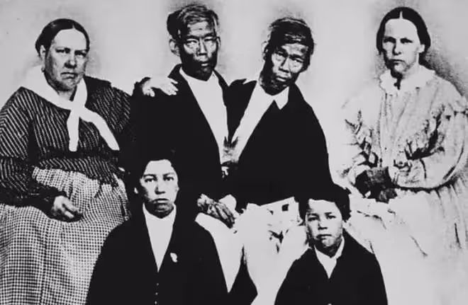 連體人也能結婚生子?兄弟倆娶親姐妹,生22個孩子,結局令人感慨
