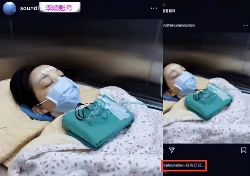 疑似王菲女兒李嫣帳號曬唇部手術現場圖,並配文稱輕舟已過