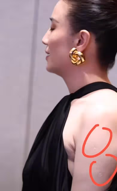 43歲宋佳近照,腋下副乳引關注,真空禮服險走光,胳膊疤痕惹爭議