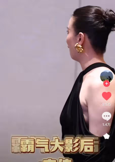 43歲宋佳近照,腋下副乳引關注,真空禮服險走光,胳膊疤痕惹爭議