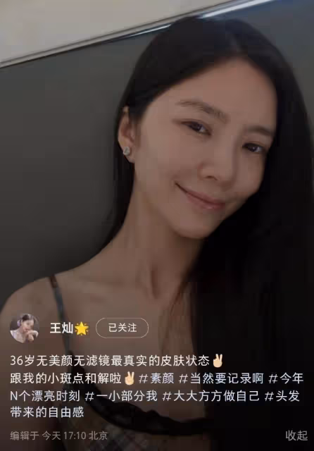杜淳36歲嬌妻自信曬全素顏，臉上斑點明顯，但皮膚緊緻看不到皺紋