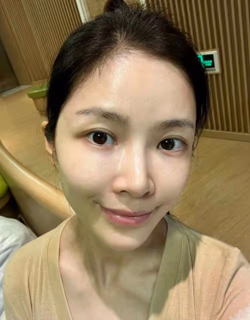杜淳36歲嬌妻自信曬全素顏，臉上斑點明顯，但皮膚緊緻看不到皺紋