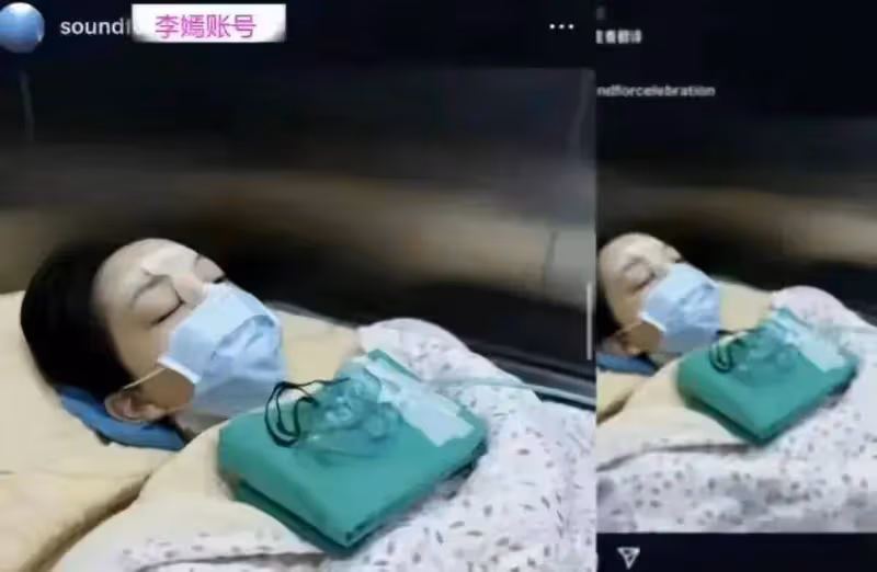 李嫣大方曬第四次唇齶裂手術畫面,終於恢復正常,這一刻等太久