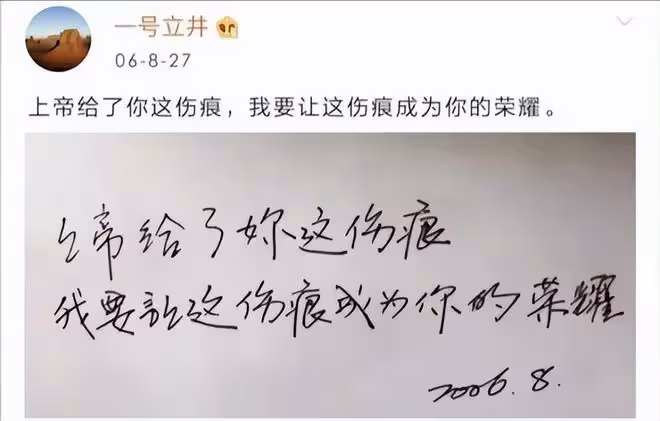 18歲李嫣4次手術成功，治好唇齶裂，神似王菲，性感出鏡太美了！
