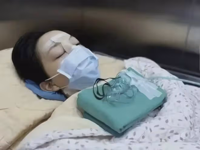 18歲李嫣4次手術成功，治好唇齶裂，神似王菲，性感出鏡太美了！