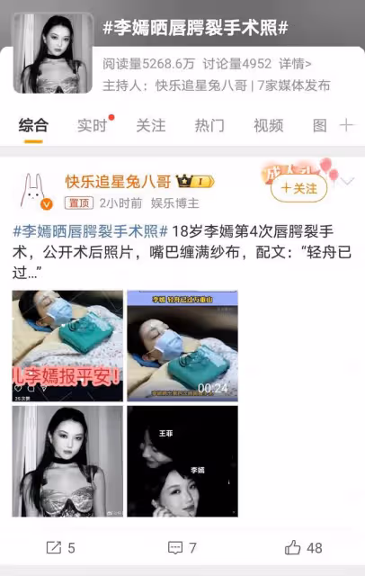 李嫣曬唇齶裂手術照,堅韌成長引關注,嫣然基金顯大愛