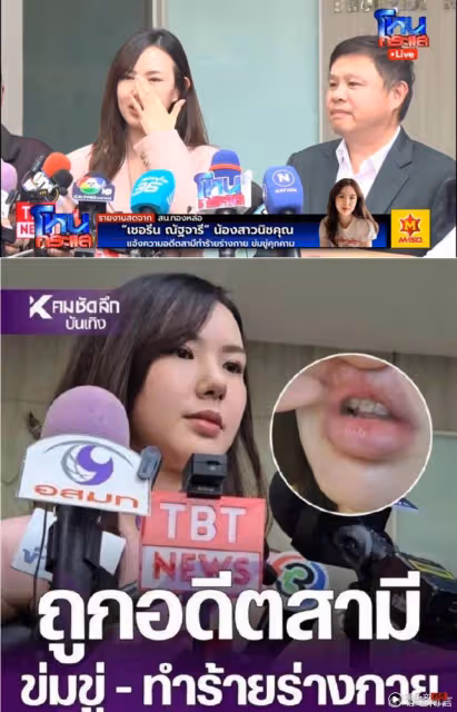 2PM Nichkhun妹妹遭前夫家暴!結婚2年挨打4次 被打到嘴破