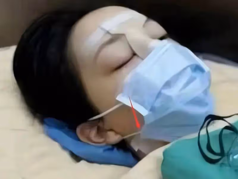 王菲陪女兒做完手術回京,李嫣戴帽子口罩顯低調,曬手術照心態好