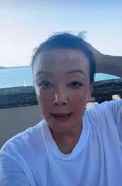 張蘭直播臉上白癜風太明顯,眉頭脖子色差太明顯,網友吐槽太拼了