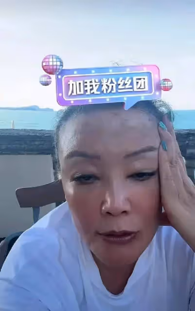 張蘭直播臉上白癜風太明顯,眉頭脖子色差太明顯,網友吐槽太拼了