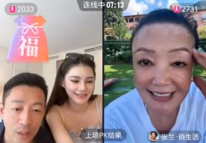 66歲張蘭到義大利治白癜風，和汪小菲跨國直播，額頭的白斑好嚴重