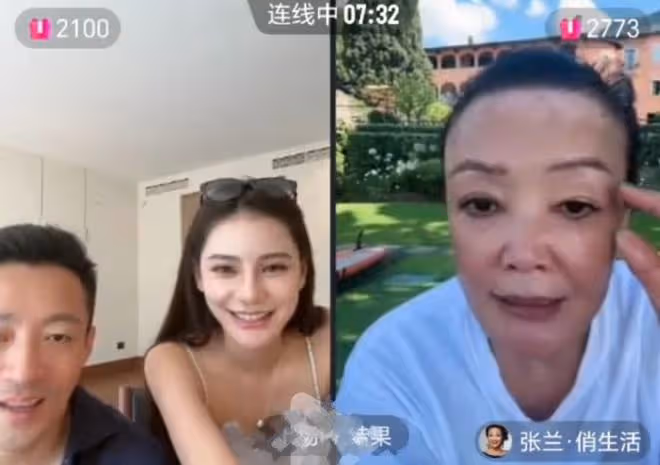 66歲張蘭到義大利治白癜風，和汪小菲跨國直播，額頭的白斑好嚴重