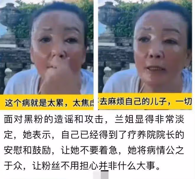 曝張蘭患白癜風!不想連累兒子跑國外治病,脖子胸前嚴重症狀蔓延