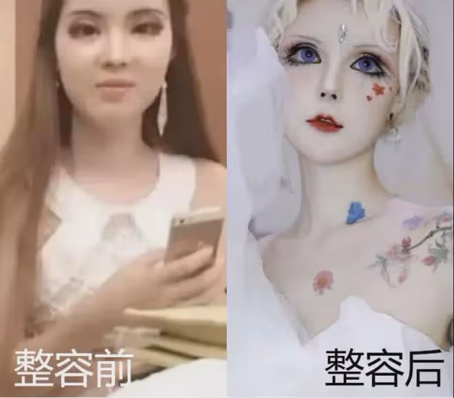 7年前，那個把自己整容成「真人芭比」的網紅迪麗拉如今後悔嗎？