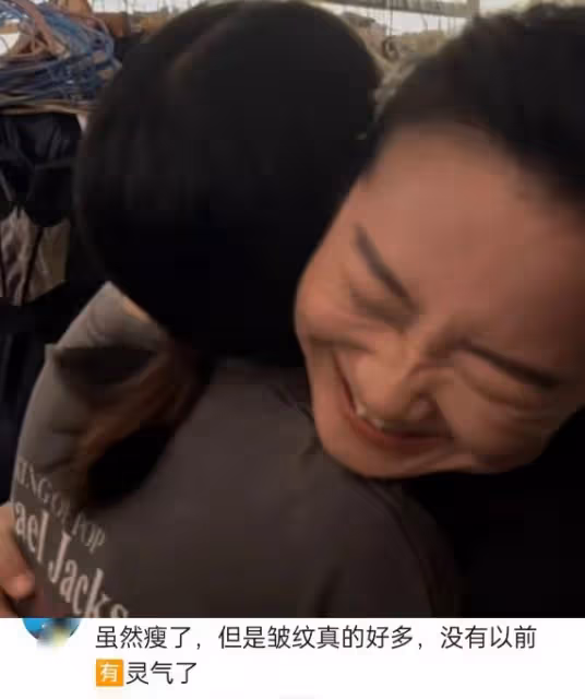 42歲賈玲近照反彈變胖,胳膊變粗皺紋多,過度減肥後遺症出來了