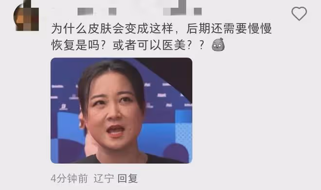 賈玲現身巴黎奧運會,卻惹來一眾嘲諷,瘦了的賈玲為什麼被討厭了