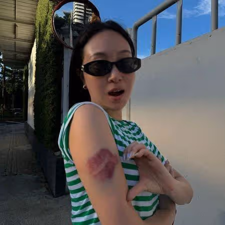 楊佑寧妻「舞台下慘摔」傷勢曝光！　伸手擊掌婁峻碩失敗：太丟臉了