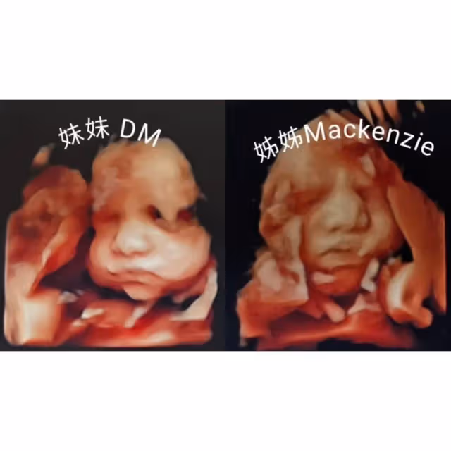 「最美孕婦」葉瑋庭曬28週巨肚　甜曝洋老公想生3個女兒又更近一步