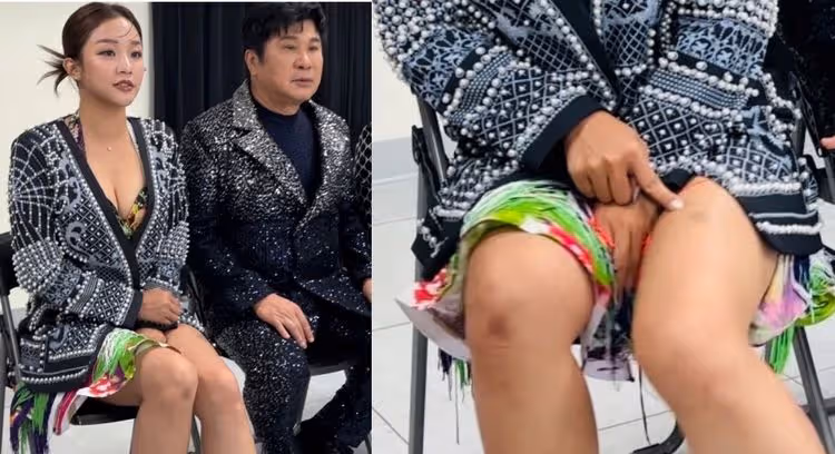 賴慧如爆乳二婚才結婚1年　身上驚冒大片瘀青疑遭家暴